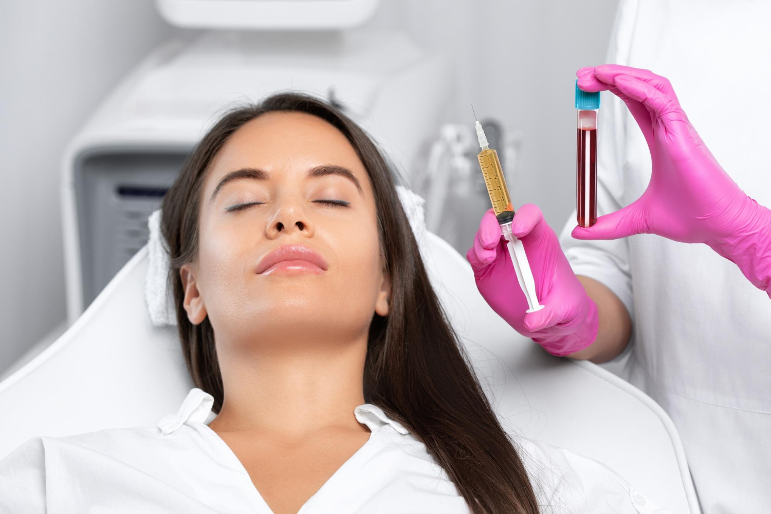Plasmilift microneedling with PRP image